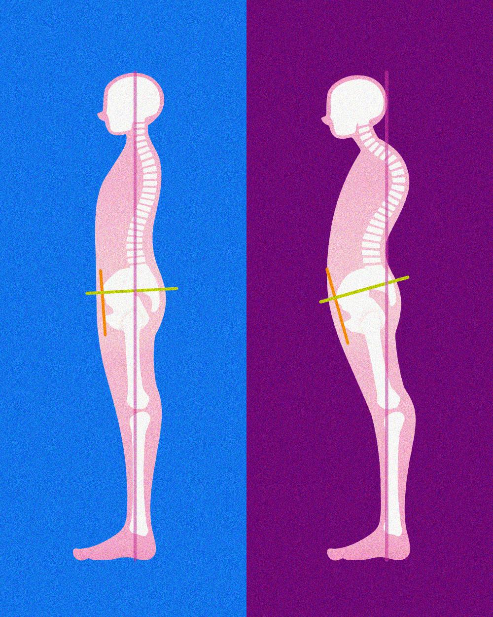 “現代のクセ”ことカイホロードシスを整え、肩甲骨と股関節を自由に！