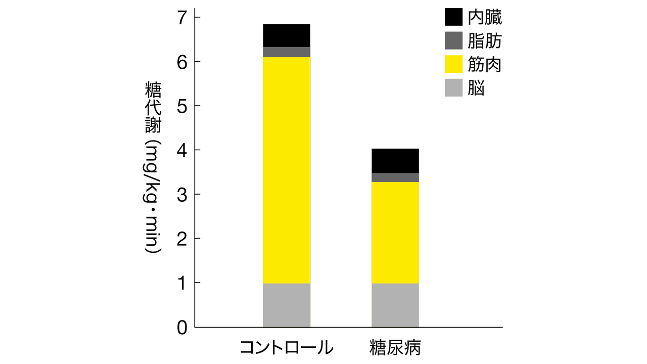 糖尿病による筋肉の減少を止める方法