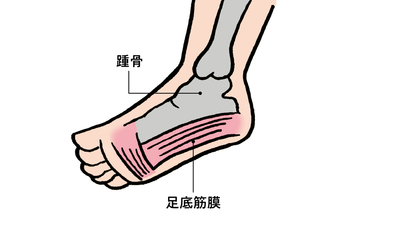 踵の骨と拇趾球をつなぐ足底筋膜