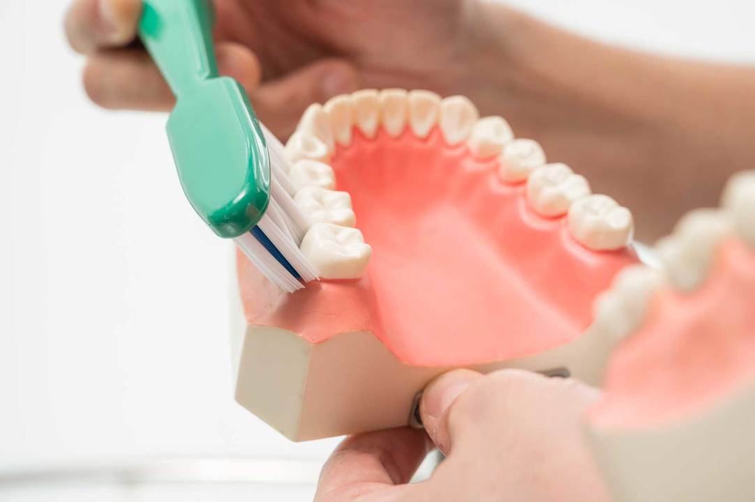不潔域とも呼ばれる歯と歯茎の境目、歯肉溝には45°でアプローチするバス法がいい。極細毛のハブラシを選べば、歯肉溝の底まで届き、歯周病菌をかき出せる可能性が高い。