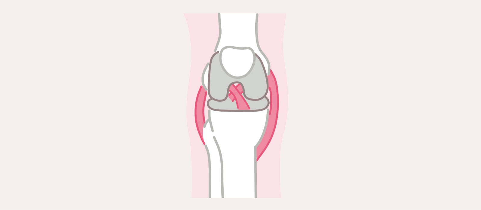 膝の障害 解説 膝関節を構成する3つの骨（大腿骨、脛骨、膝蓋骨）