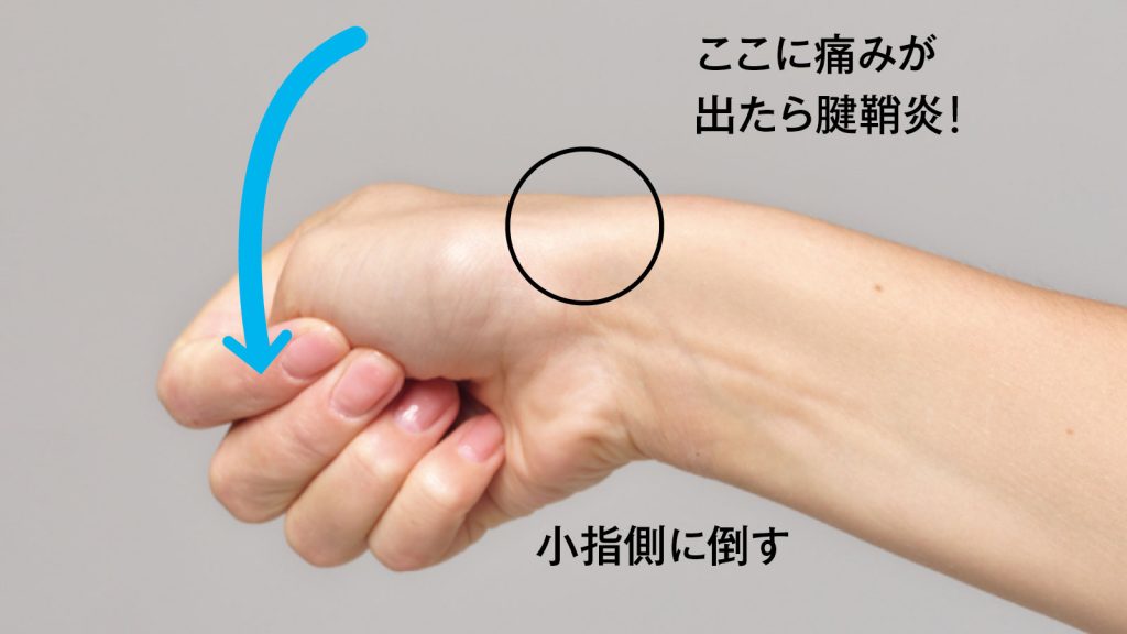 腱鞘炎と腱鞘炎の違いは何ですか?