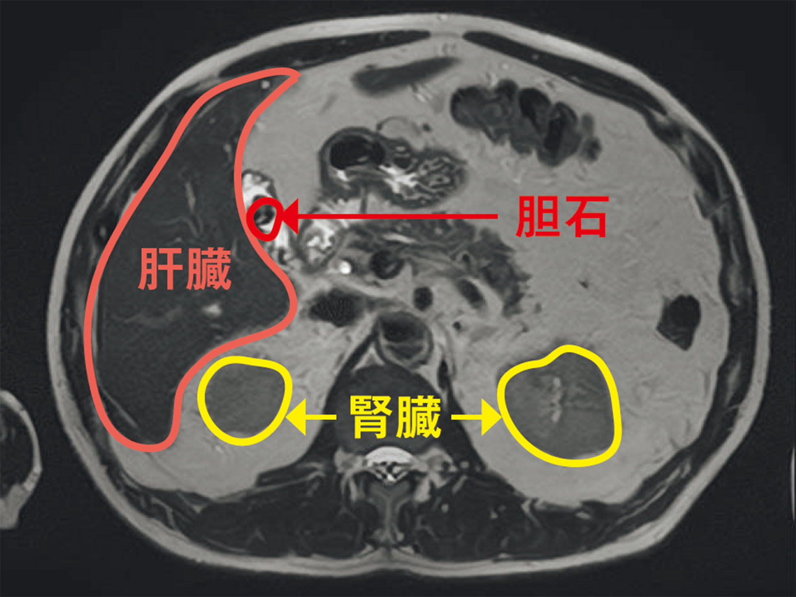 石田純一さんのMRIの検査結果
