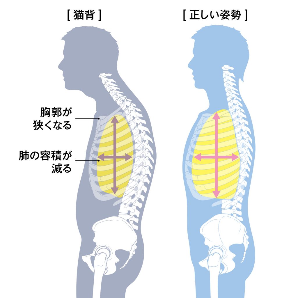 猫背で何が悪いのか? 猫背放置のデメリットを知り病気リスクを回避しよう。