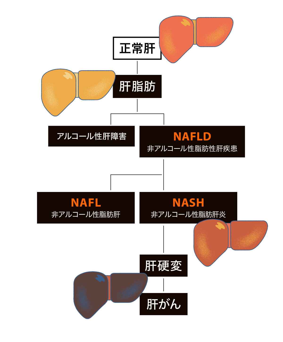 肝臓　肝がんになるまでの過程