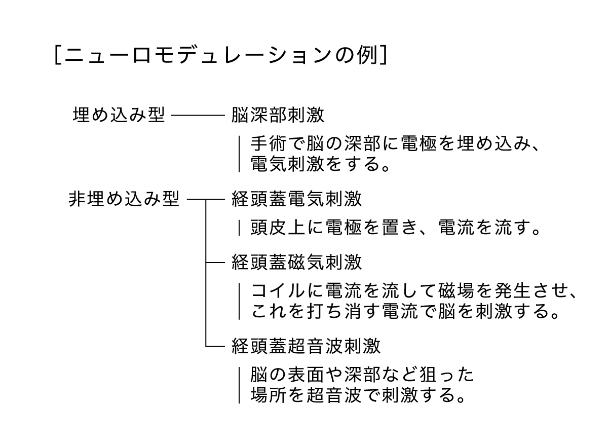 ニューロモデローションの例