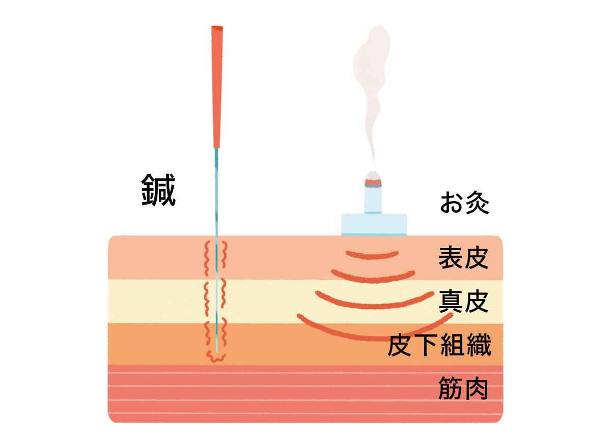 お灸と鍼の刺激で共通する作用