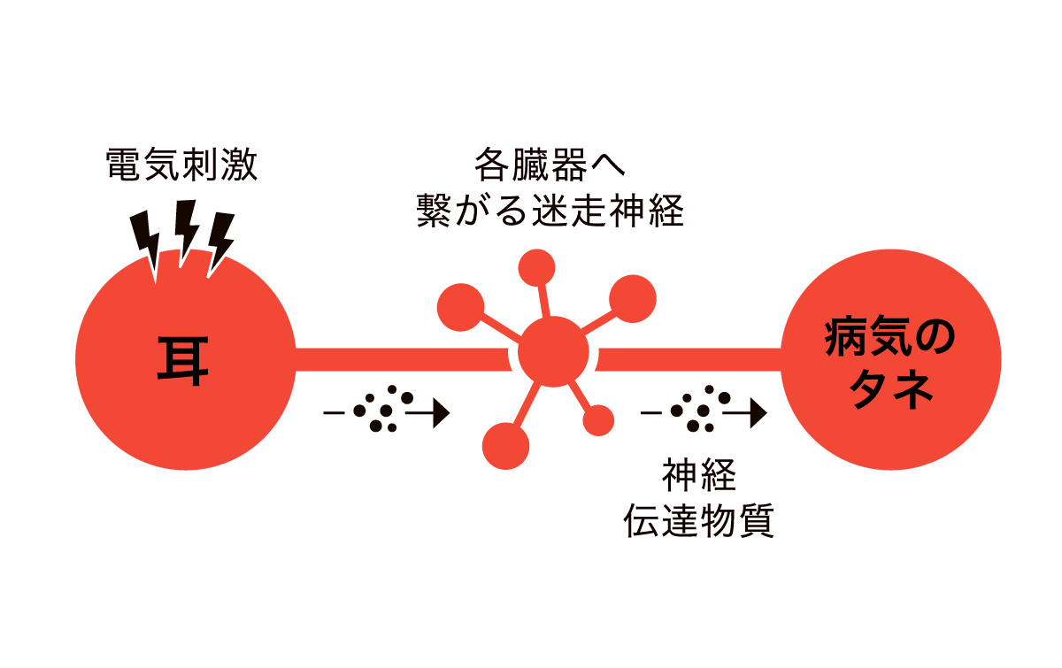 耳ツボで未病が治るかも