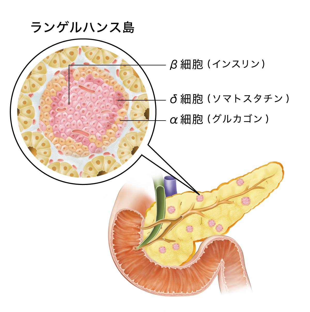 ランゲルハンス島