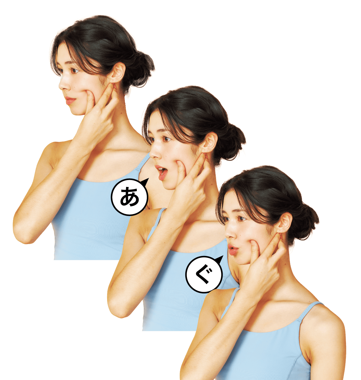 口角引き上げ