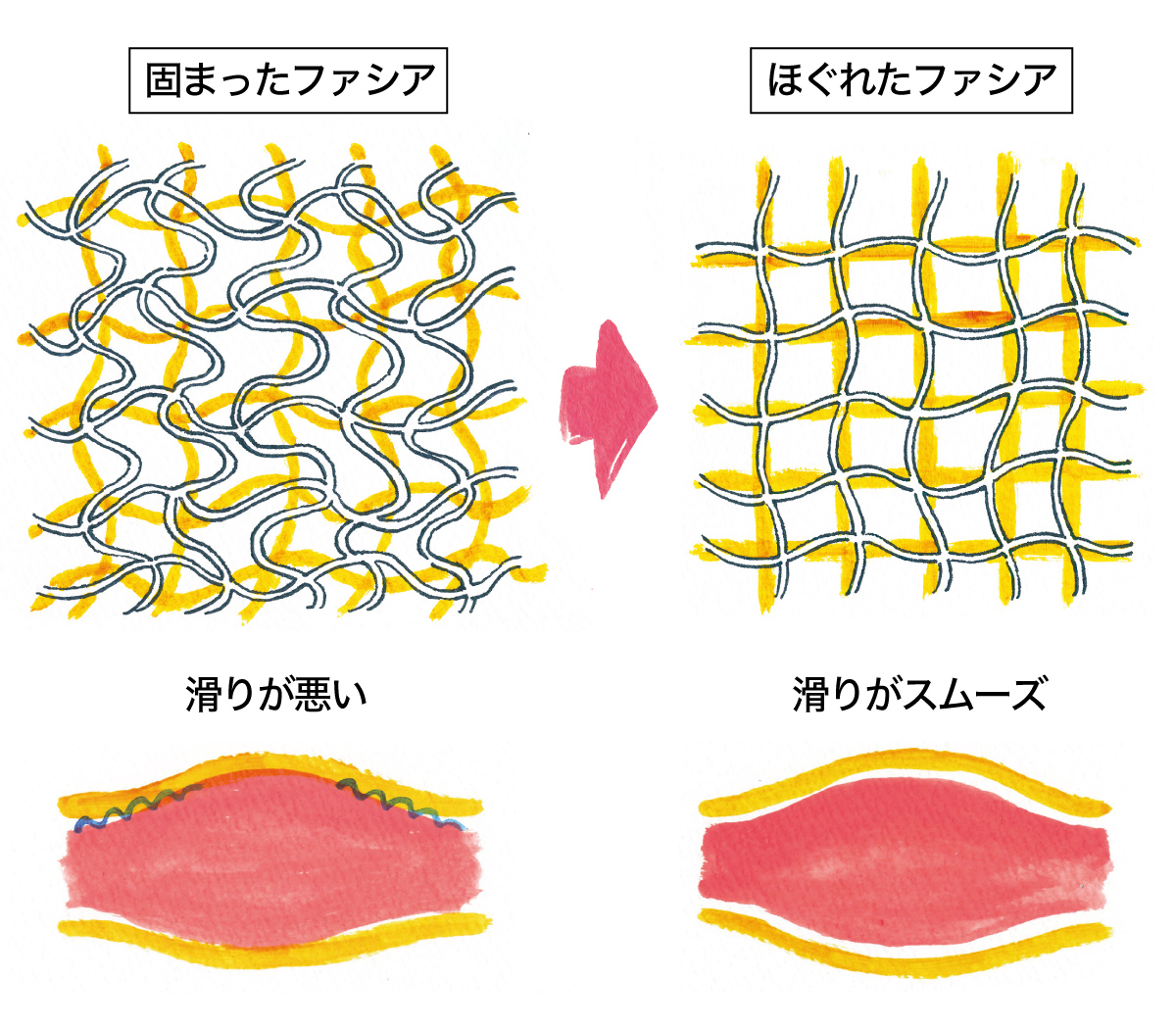 筋肉を包むファシアの変化