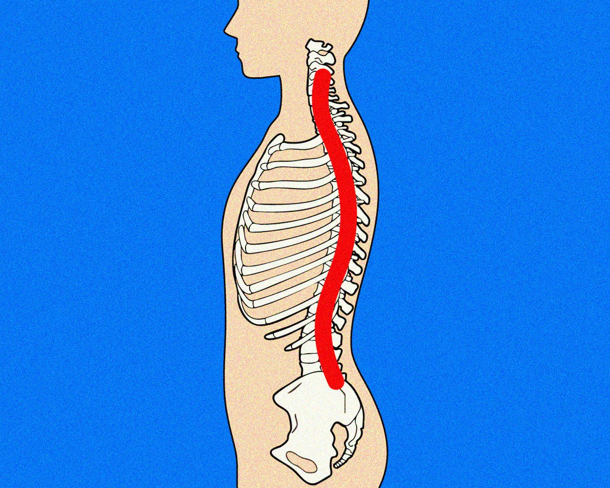 猫背による背骨のC字化の治し方。
