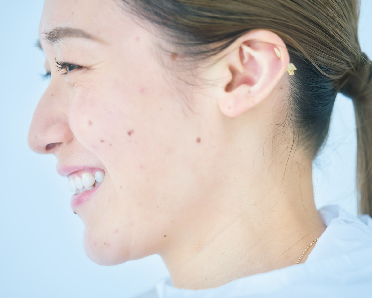 バレーボール石川真佑