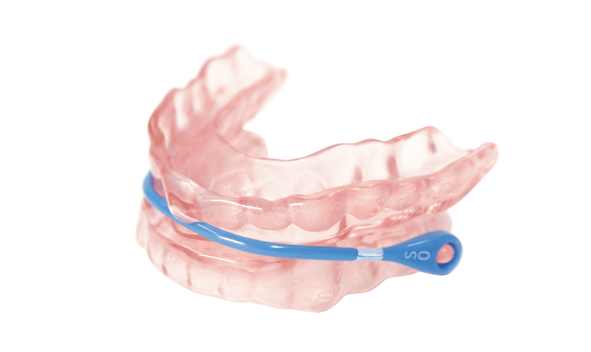 口腔内装置の最新版・ソノムデント アヴァント（自由診療）