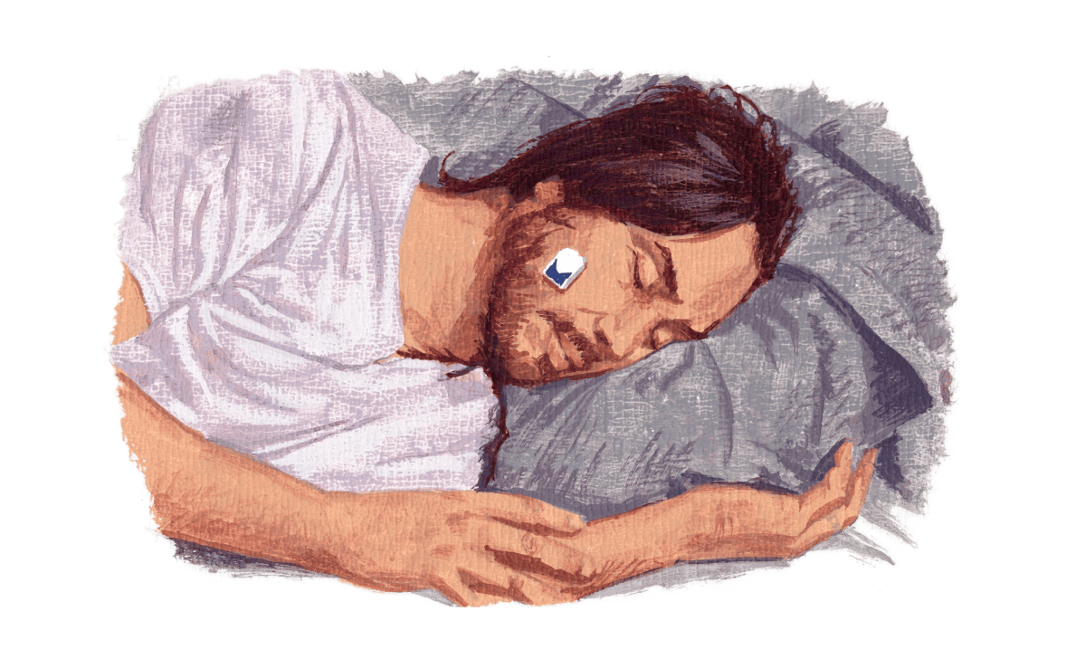 奥歯を嚙み締めた時に膨らむ咬筋あたりに機器を貼り付けて一晩計測する。