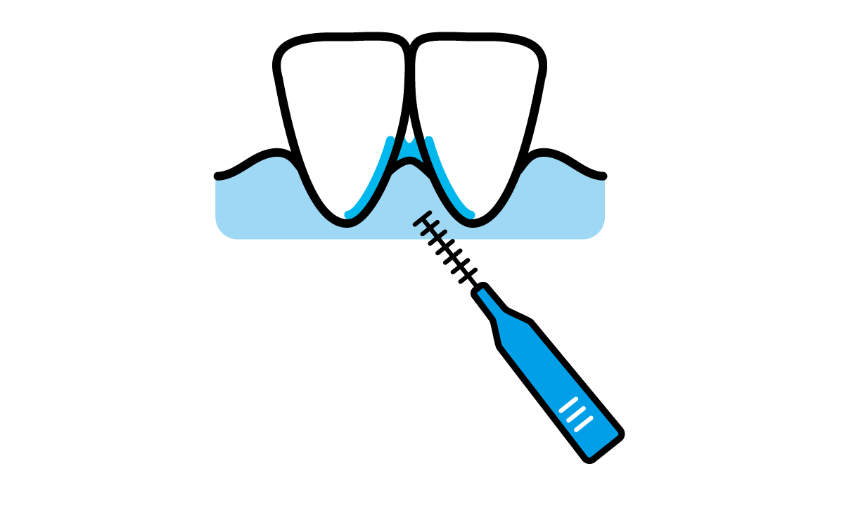 歯間ブラシのイラスト