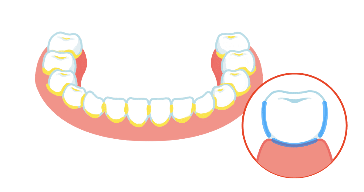 歯を磨く場所のイメージ図