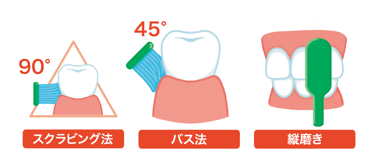磨き方、縦磨きとバス磨きとスクラビング法のイラスト