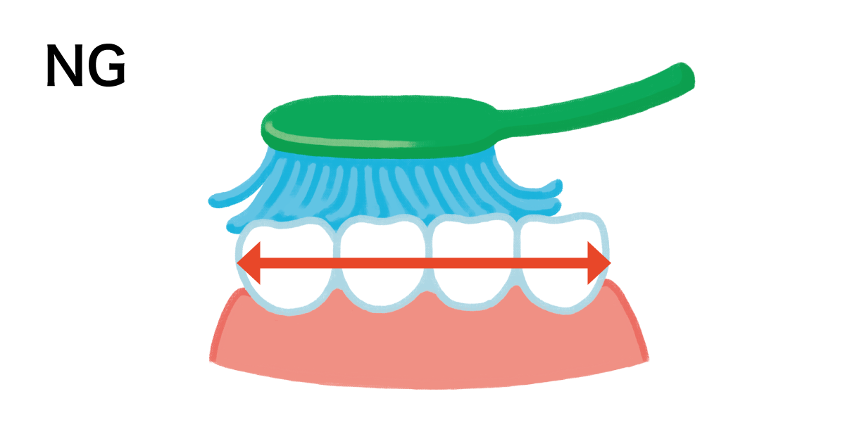 NGのバラシの使い方、ブラシが潰れている