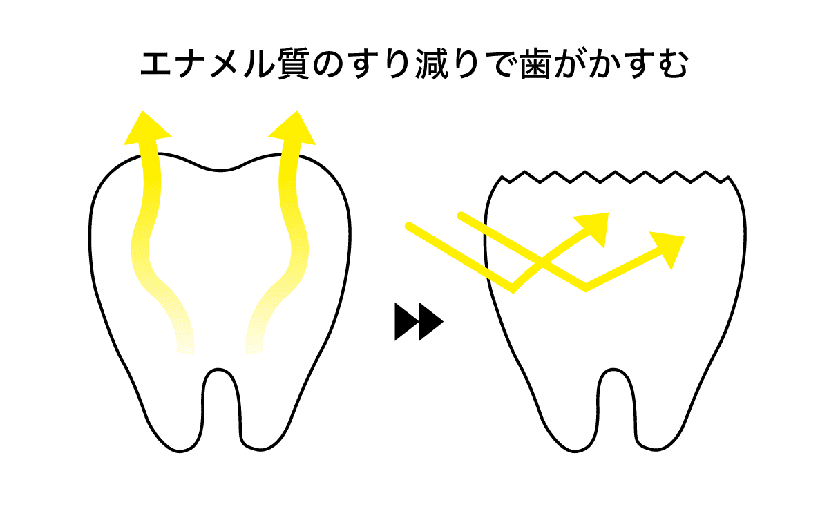歯がくすむ原因のイラスト