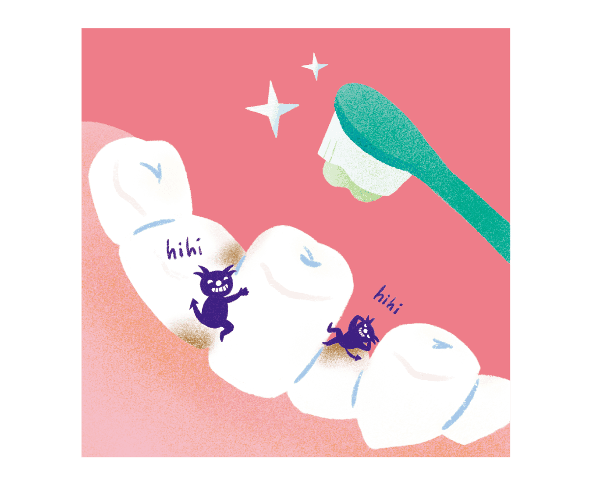 虫歯がいる歯を歯ブラシで添水するイラスト