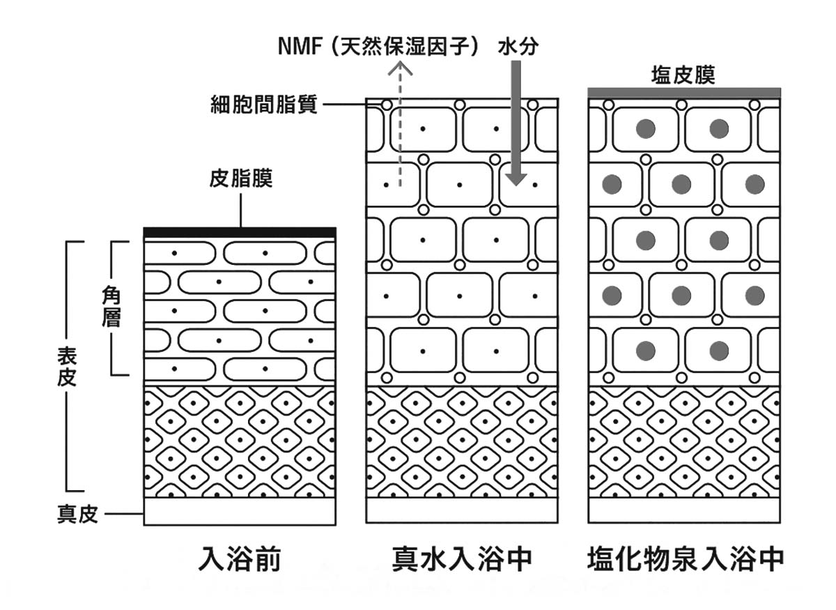 水道水と温泉水の入浴時では皮膚表皮の状態が異なる