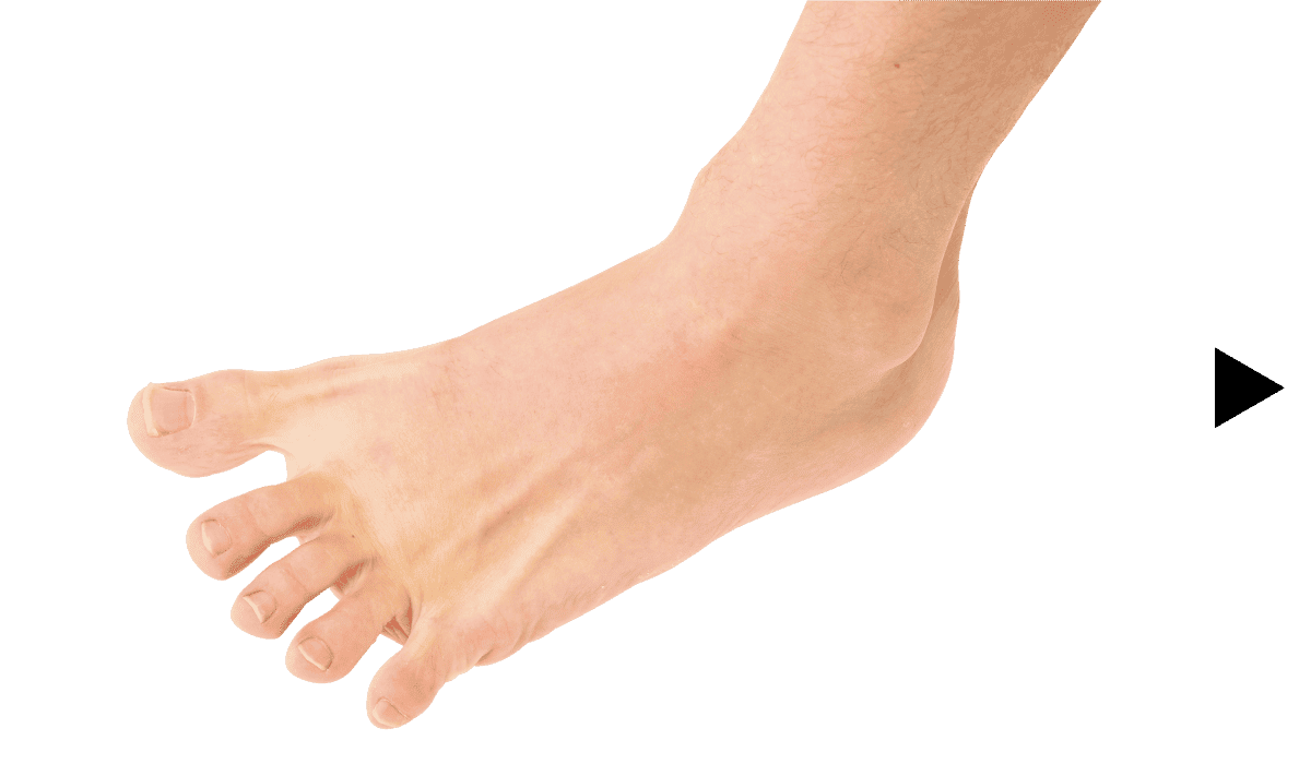 グー、チョキ、パー