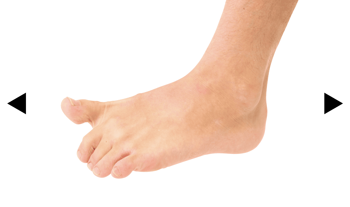 グー、チョキ、パー