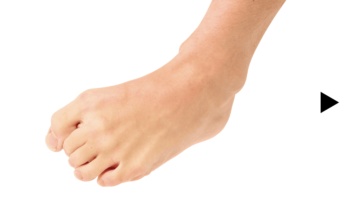 グー、チョキ、パー