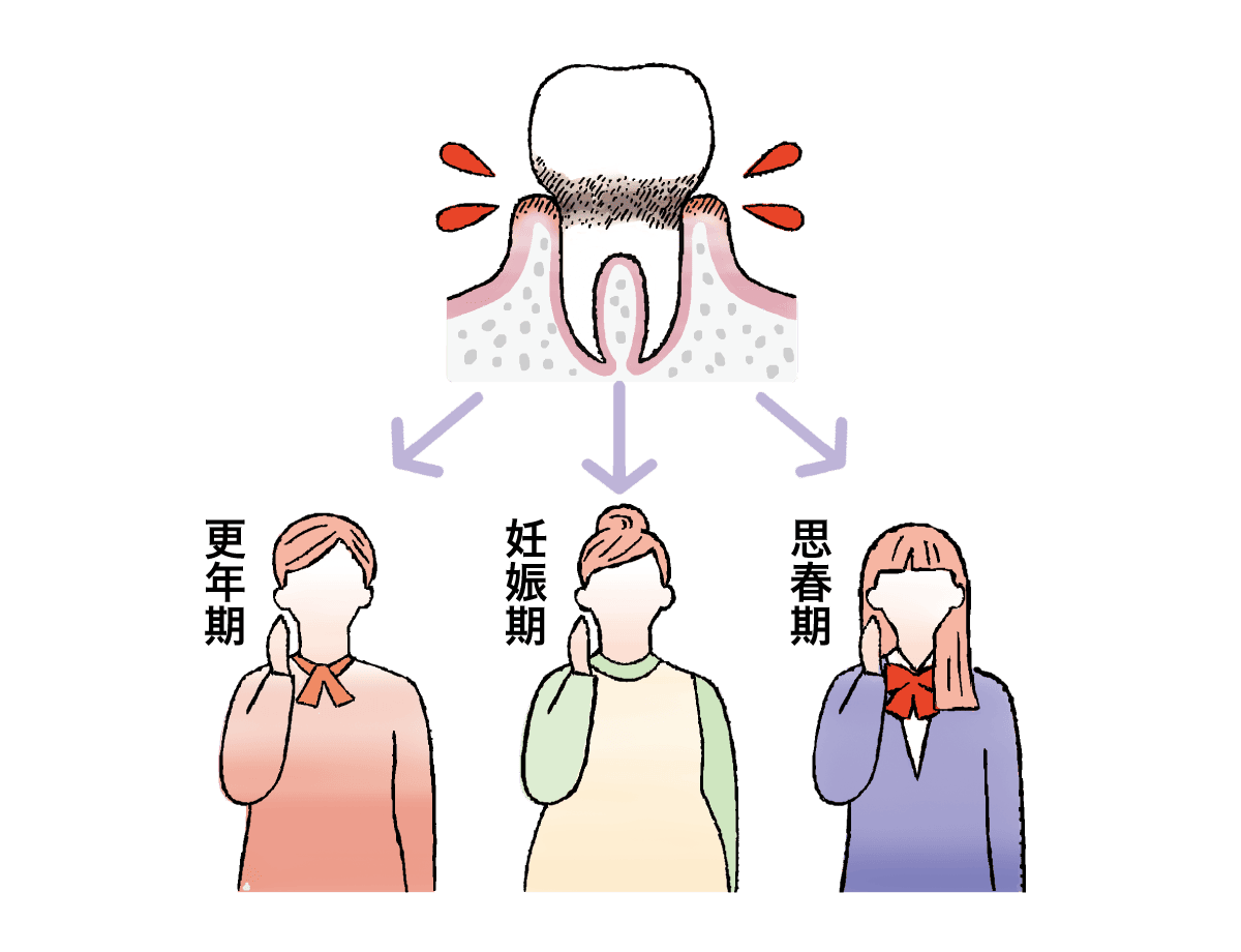 女性は三度歯周病になりやすい