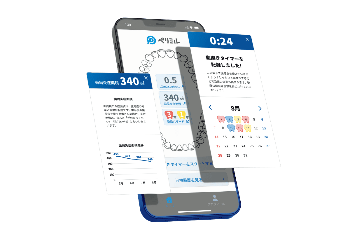 12週間プログラムで口腔ケアを誘導してくれる『ペリミル』のアプリ画像