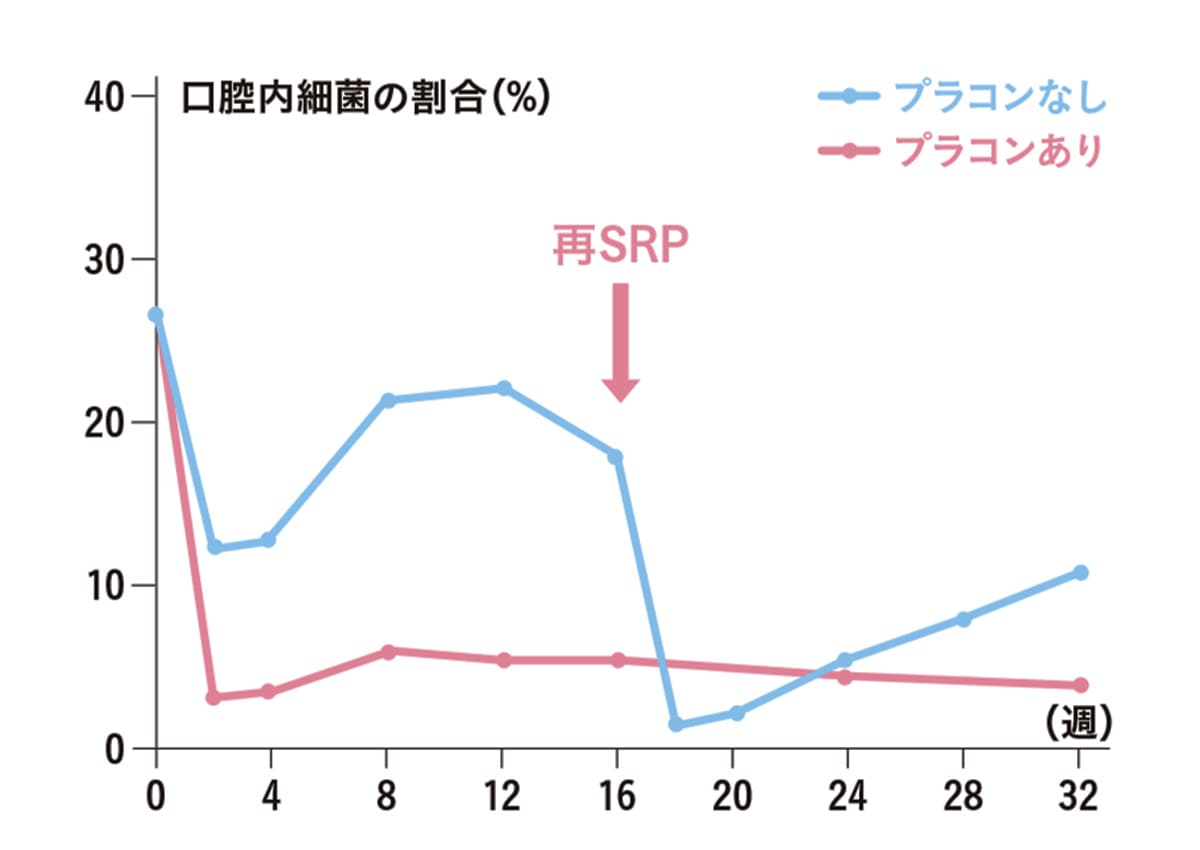 歯周病治療後の細菌の割合を比較するグラフ