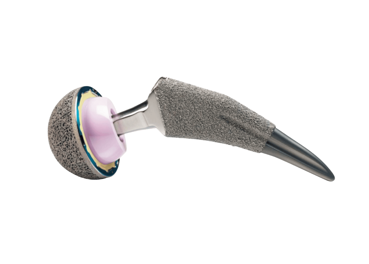 人工股関節の画像