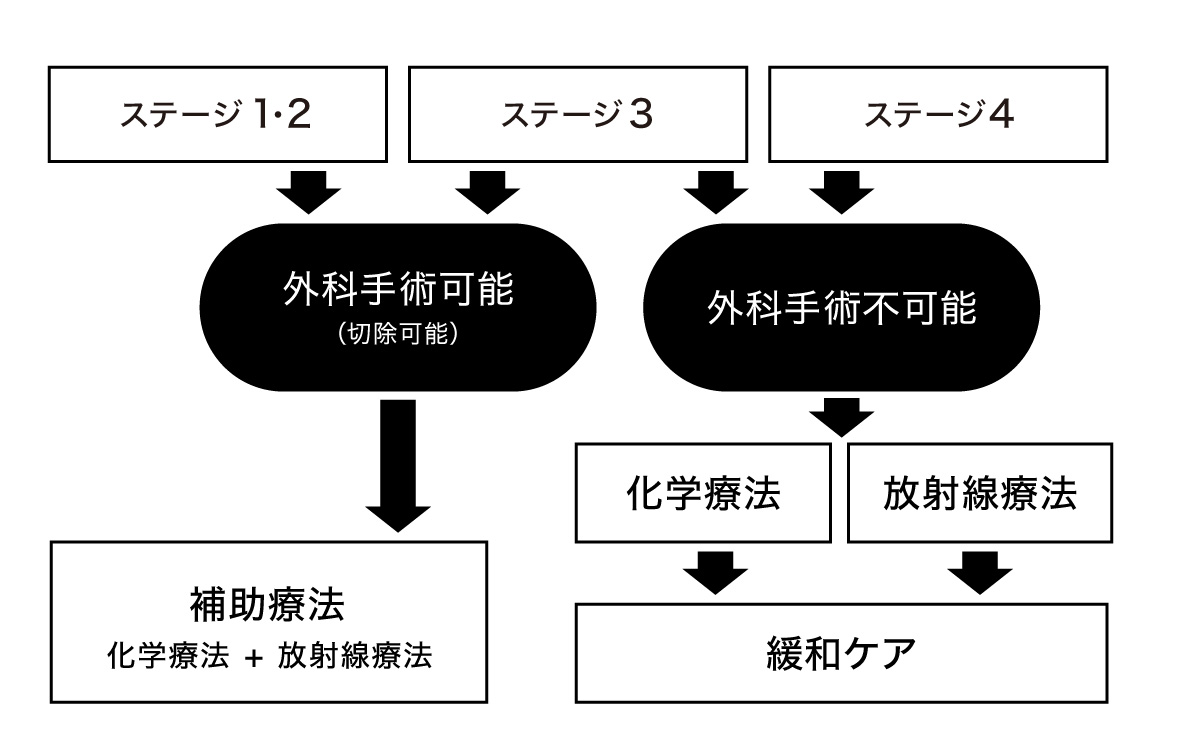 膵臓がんのステージと治療方法の図