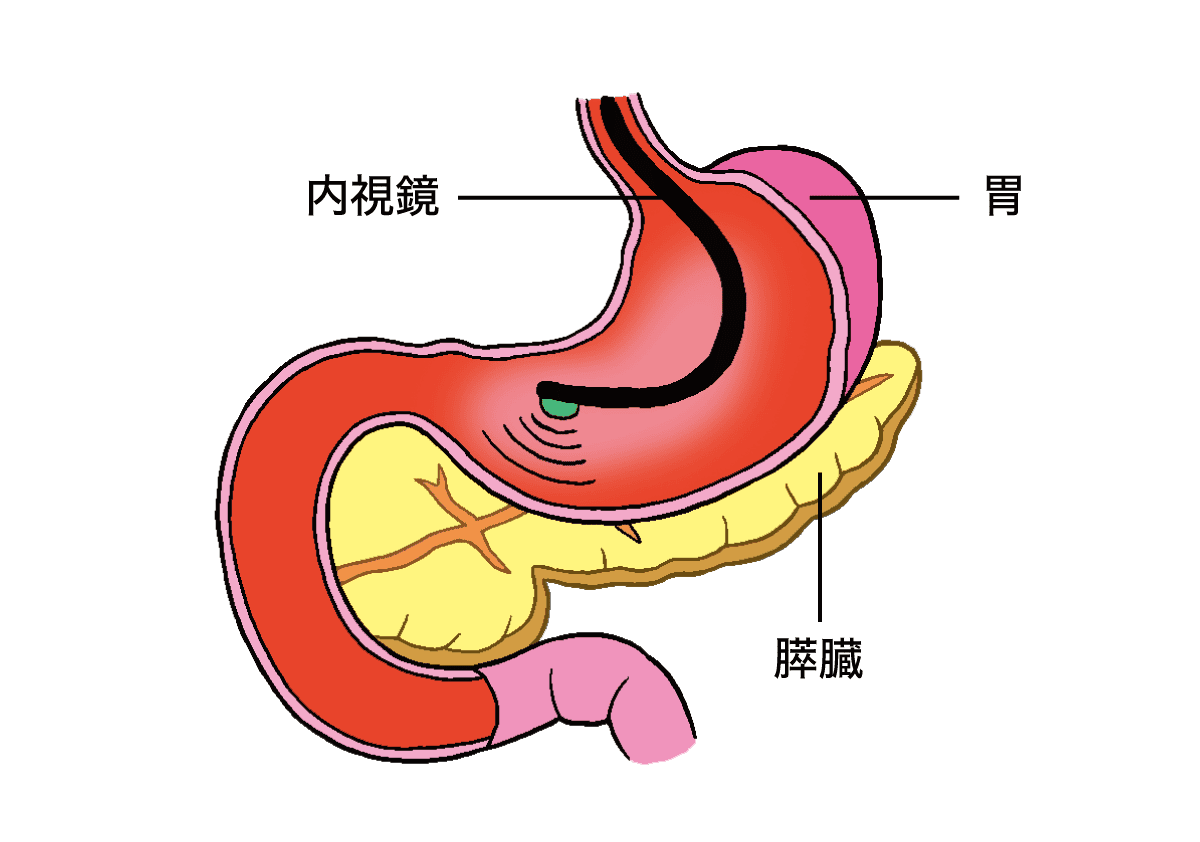 超音波内視鏡（EUS）検査のしくみ
