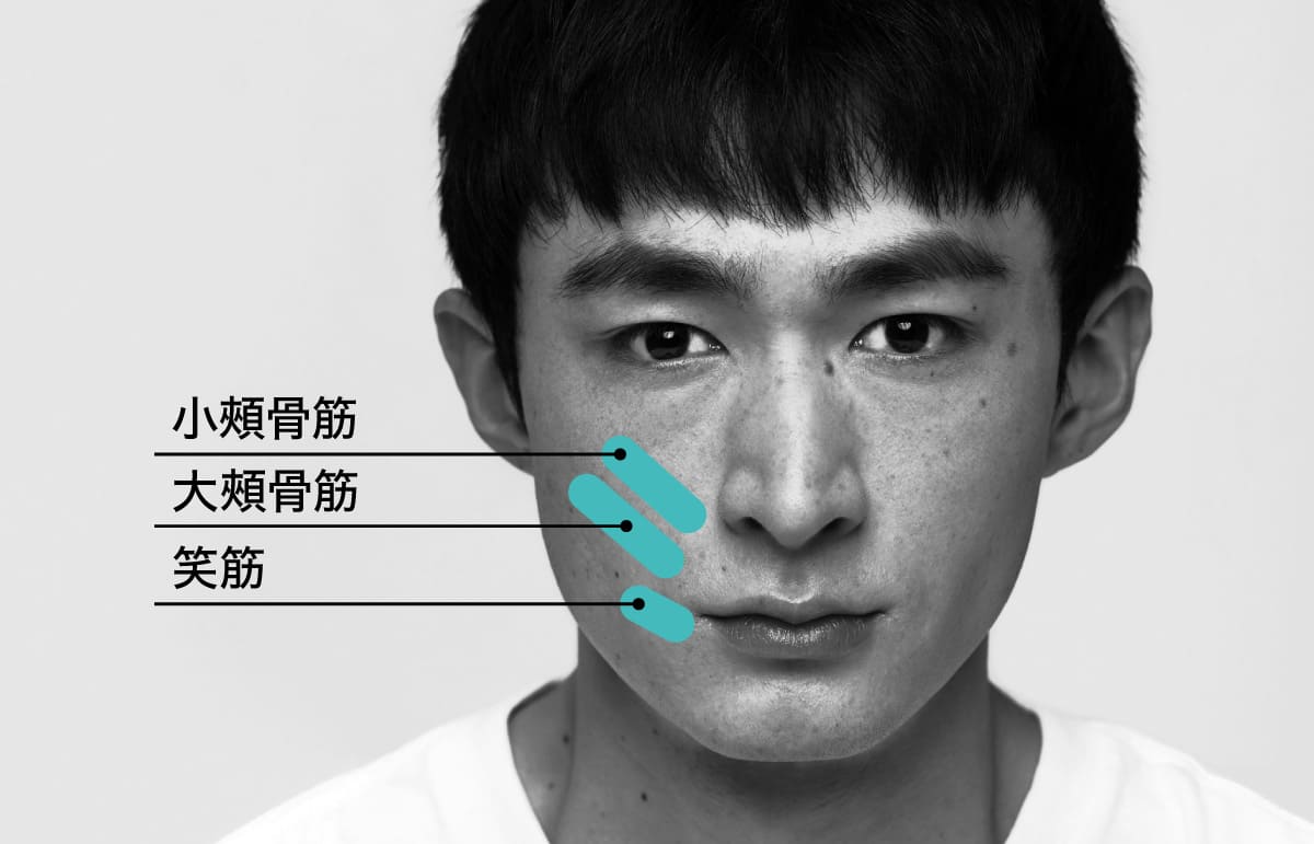 男性の顔に小頬骨筋・大頬骨筋・笑筋の箇所を示している