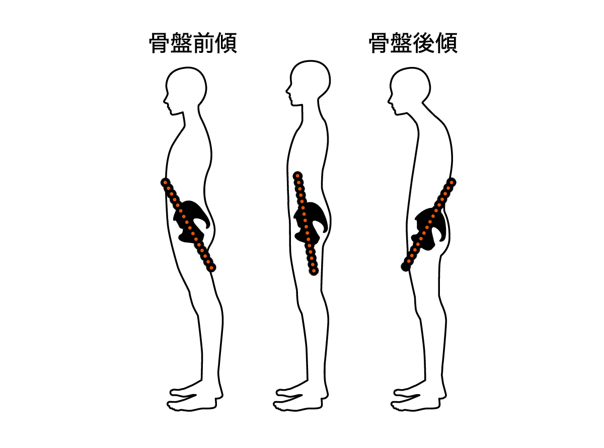 骨盤前後しているイラスト