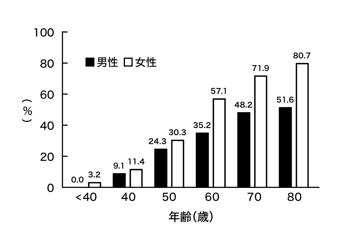 変形症膝関節症の有症率グラフ