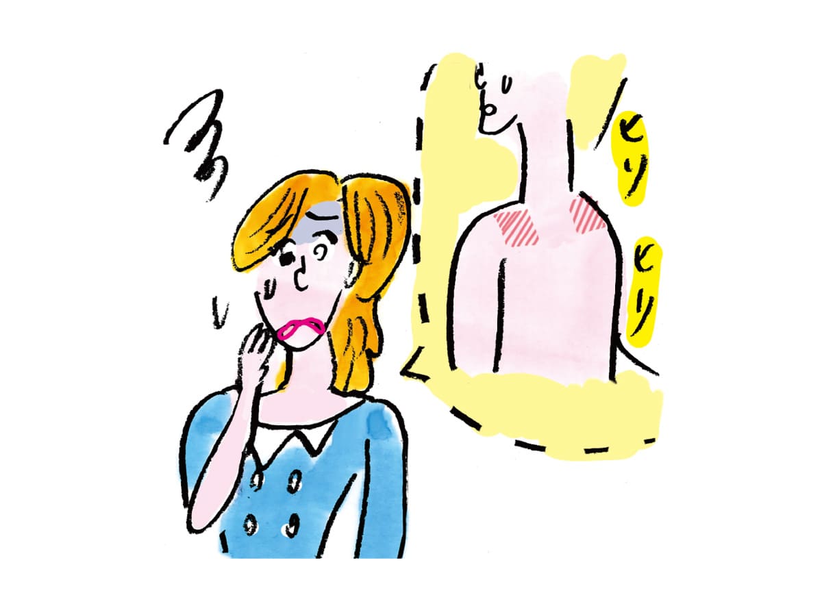 光線過敏症のイラスト