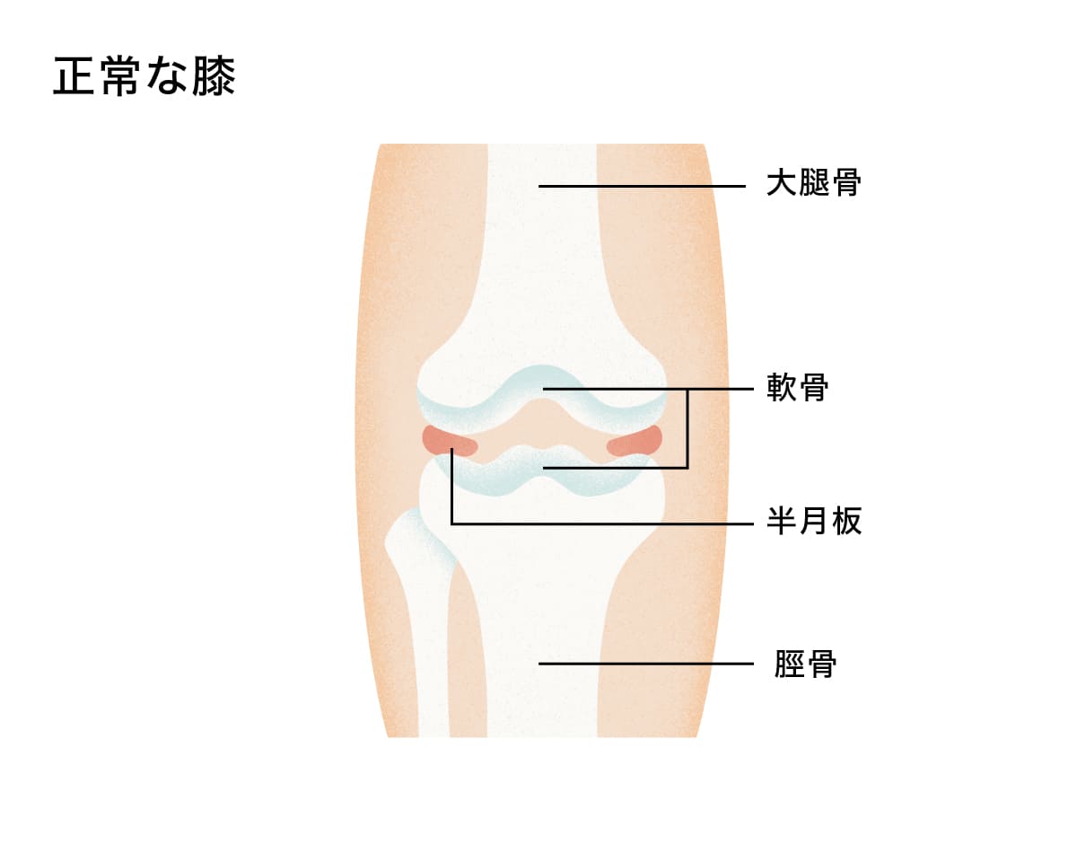 正常な膝