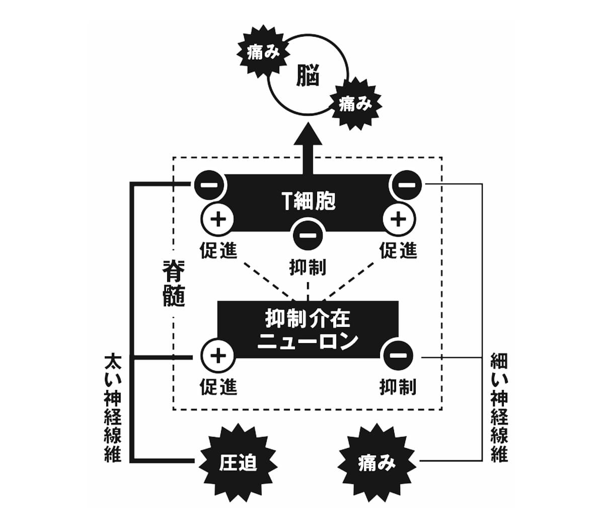 ゲートコントロール説