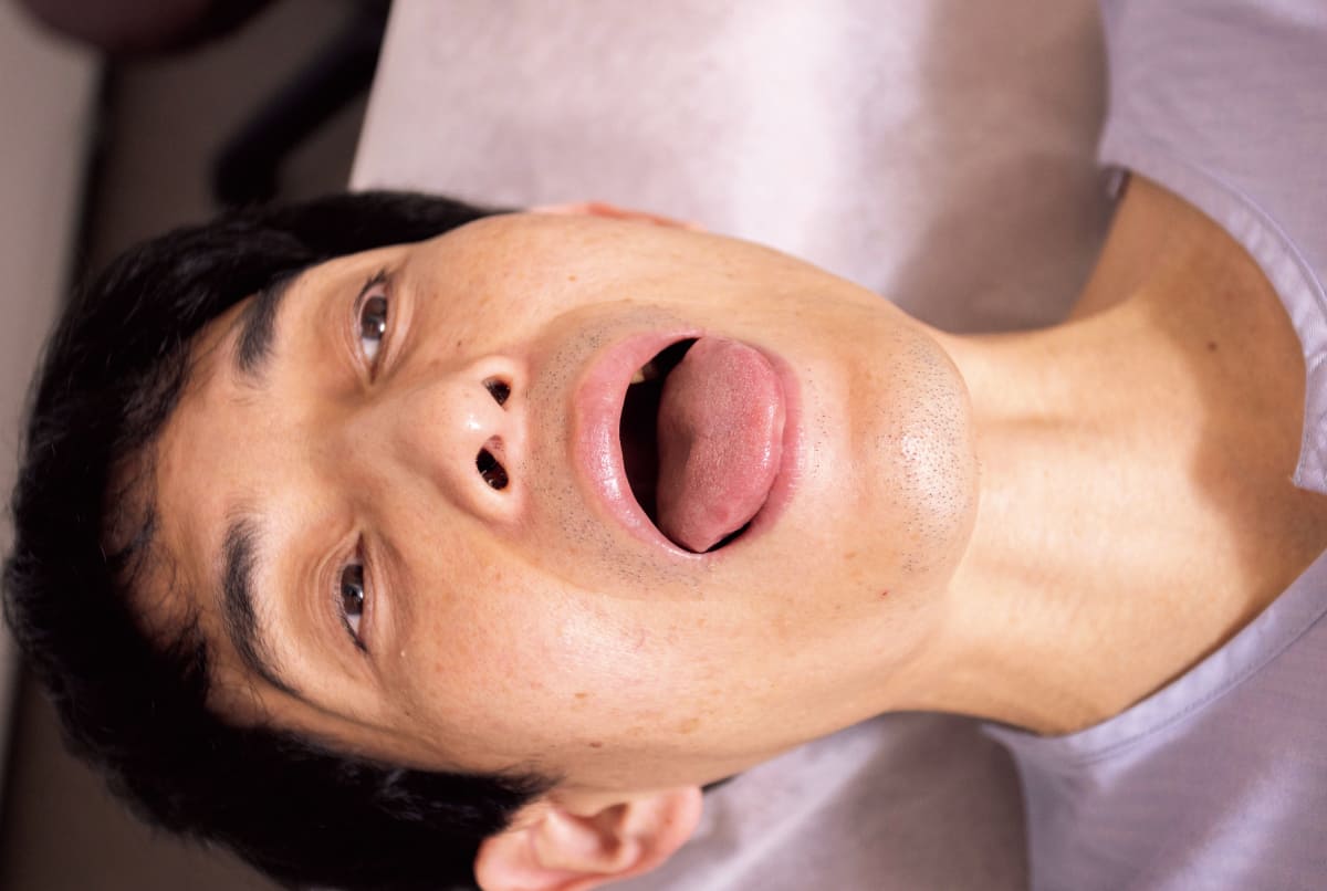 舌診の様子