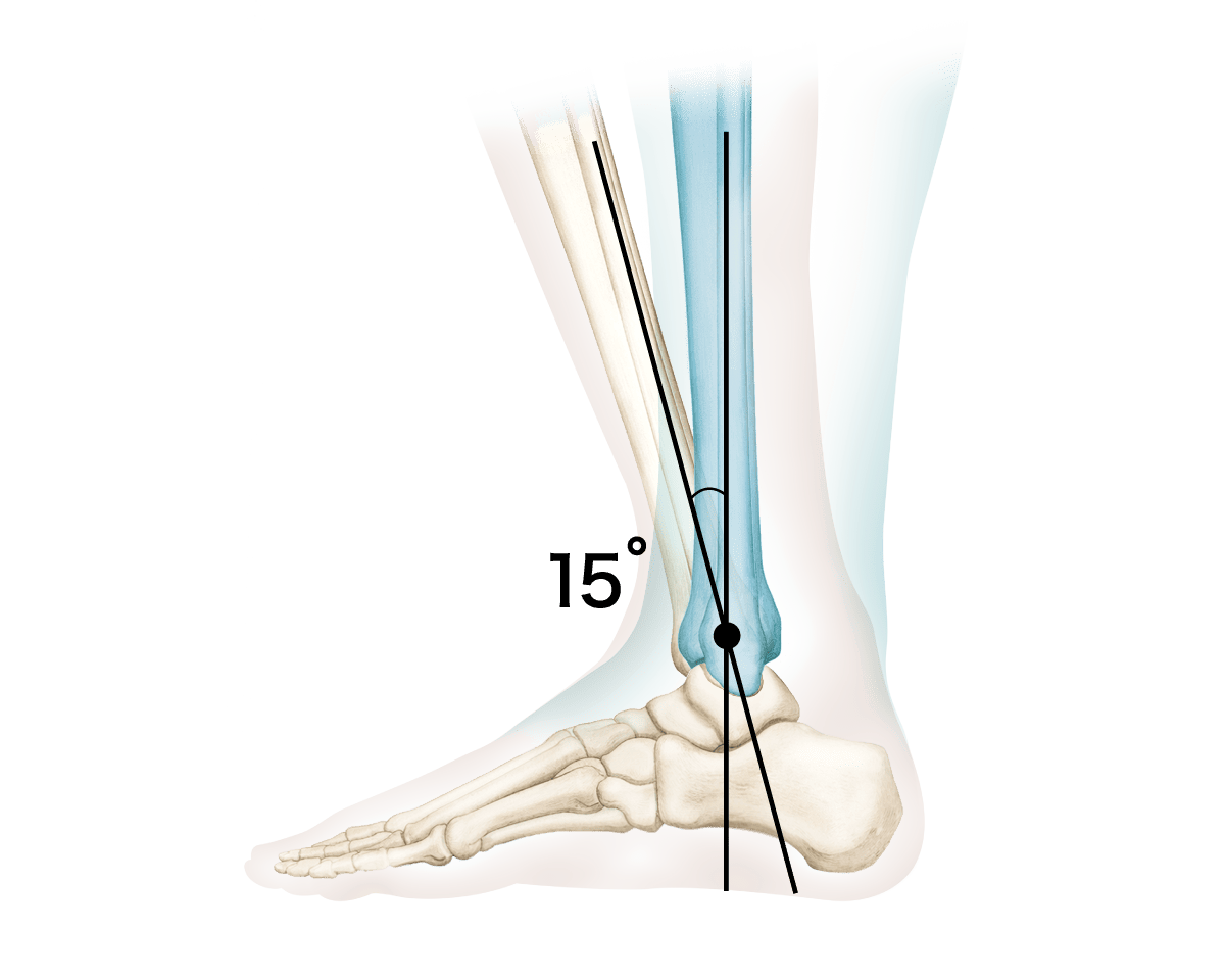 足関節が15°が稼働しているイラスト