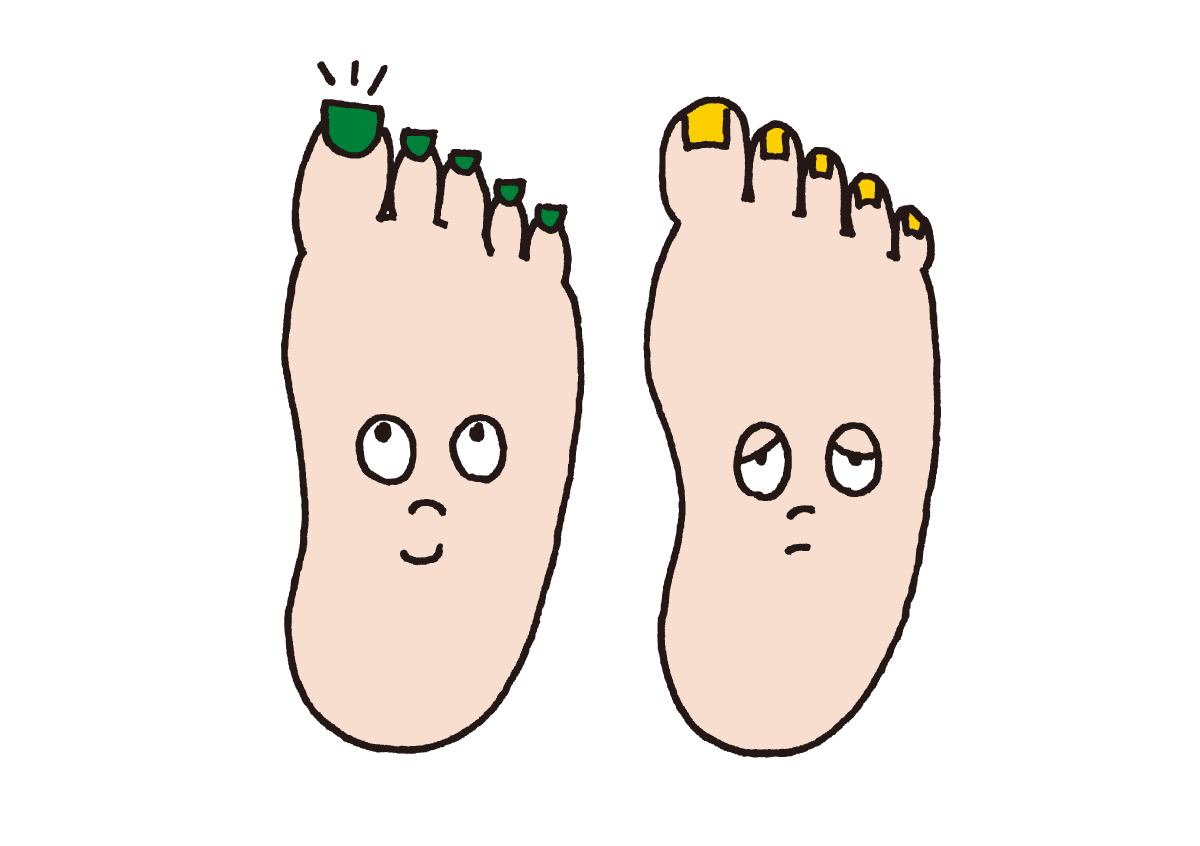 足の爪が巻き爪になっている様子