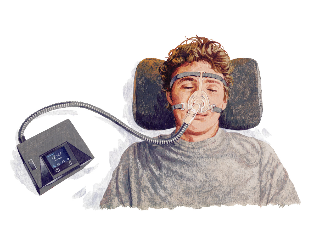 人類の睡眠を救う、CPAPとは？