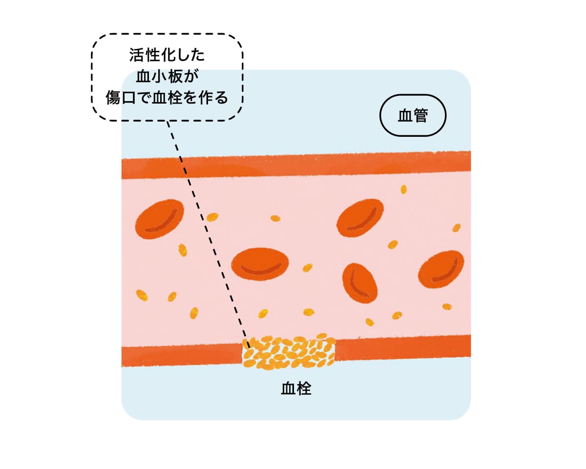 止血の様子